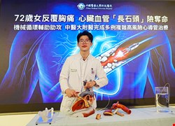 72歲女反覆胸痛 心臟血管「長石頭」險奪命 機械循環輔助助攻 中醫大附醫完成多例複雜高風險心導管治療案例