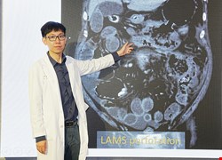 前往 小小膽結石恐引發壞死性胰臟炎 中醫大附醫多專科團隊合力逆轉重症 大幅提升存活率