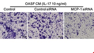 MCP-1 controls IL-17-promoted monocyte migration and M1 polarization in osteoarthritis img