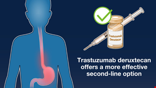 Trastuzumab Deruxtecan or Ramucirumab plus Paclitaxel in Gastric Cancer img